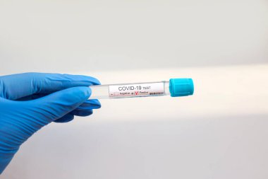 Doktorlarda Coronavirus testi beyaz arka planda yapılır. Covid-19 testi