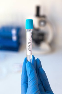 Mikrobiyologların eline eldiven takıp Coronavirus için pozitif bir kan testi yapın. Covid 19