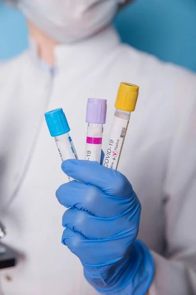 Badanie Krwi Koronawirusa Laboratorium Midycznym Wynik Dodatni Teście Covid — Zdjęcie stockowe