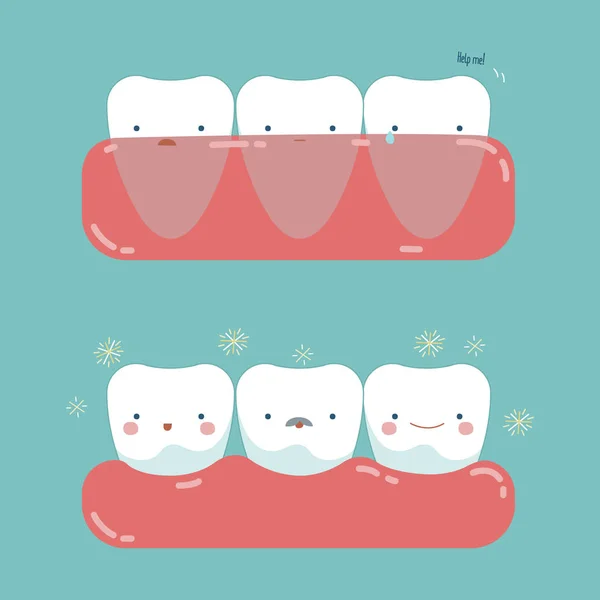 Cirurgia de gengiva para dentes bonitos de dentista — Vetor de Stock