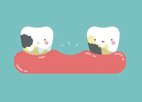 Karies Zähne, Zähne und Zahnkonzept der Zähne — Stockvektor
