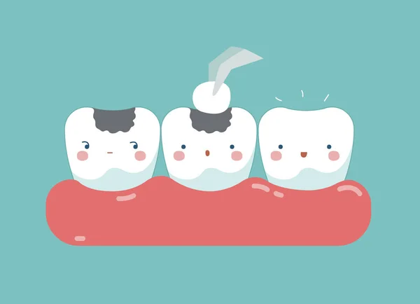 Llenado de dientes, dientes y concepto de dientes de odontología — Archivo Imágenes Vectoriales