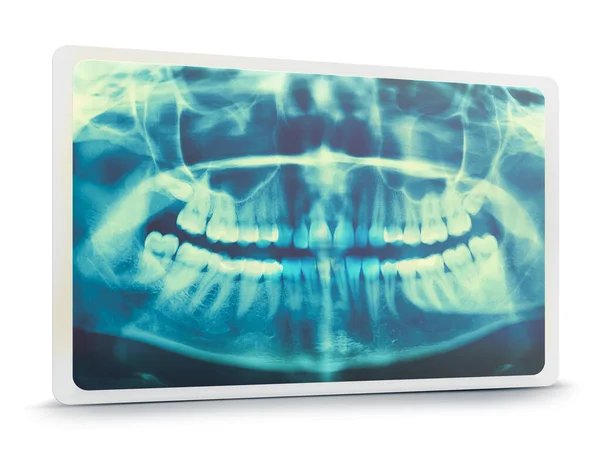 Woman x-ray of the teeth wisdom teeth horizontal pozition problem dentistry medicine. Panoramic image of teeth. 3d render — Stock Photo, Image