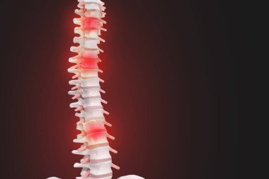 İnsan omurga anatomisi. İskelet insan omurgası ve omurga o