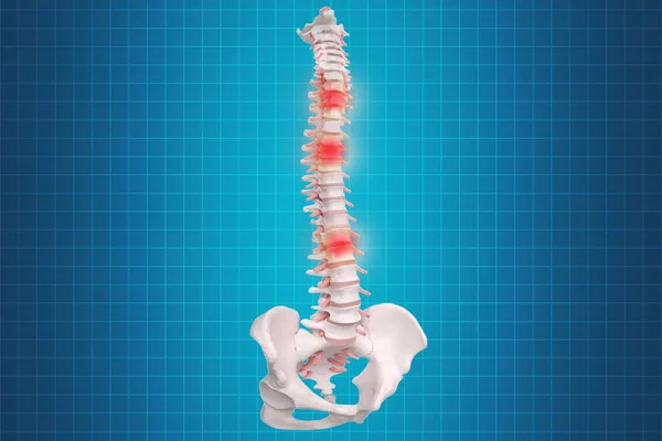 Mänsklig ryggradsanatomi. Människans skelettryggrad och ryggrad o — Stockfoto