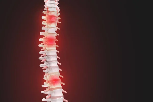 Mänsklig ryggradsanatomi. Människans skelettryggrad och ryggrad o — Stockfoto