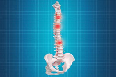 İnsan omurga anatomisi. İskelet insan omurgası ve omurga o