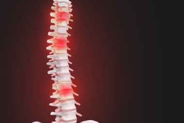 İnsan omurga anatomisi. İskelet insan omurgası ve omurga o