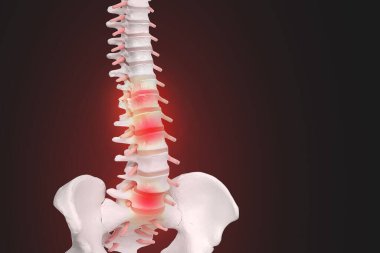 İnsan omurga anatomisi. İskelet insan omurgası ve omurga o