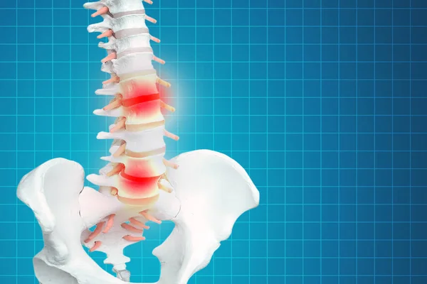 Realistic skeletal human spine and vertebral column or intervertebral discs on a dark background. Lower back pain. Vertebral column in glowing highlight as a medical health care concept.