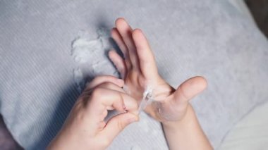 Çocuk, hastalıklı deriyi avucunun içinden alıyor..