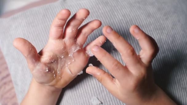 A gyermek eltávolítja a bőrt egy égési sérüléstől a kezén.. — Stock videók