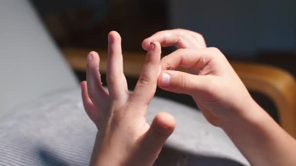 Çocuk derisini parmaklarından soyar. Deri hastalığı. — Stok video
