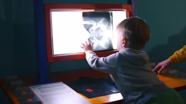 Boy pone imágenes de rayos X en la pantalla de luz . — Vídeos de Stock