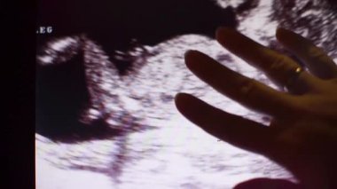 Bir insan çocuğunun embriyosunun ultrason taramasının siyah beyaz fotoğrafı.