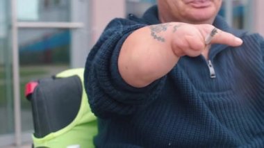 Elleri olmayan engelli bir insan sigara içer..