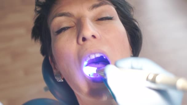 El dentista brilla azul en la boca de la niña paciente en la clínica dental — Vídeos de Stock