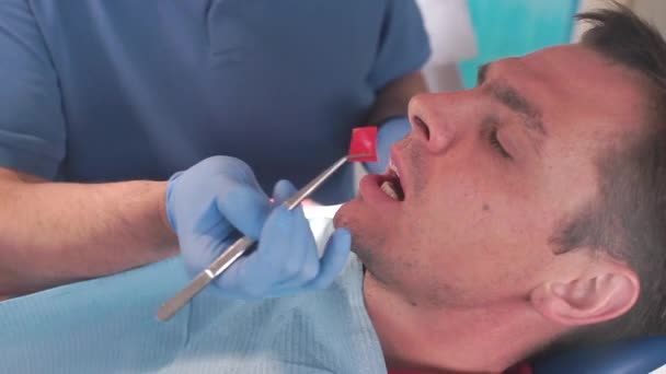 Man behandelt tanden bij de tandarts — Stockvideo