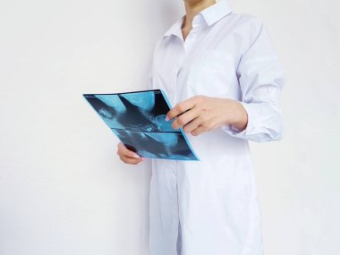 Doktor üniformalı kadın, hastalığın teşhisi olan röntgeni inceliyor..