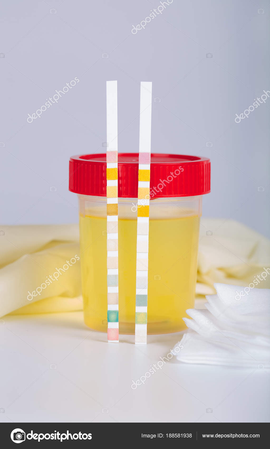 Collection cup with urine test on a table of a lab technician. Stock