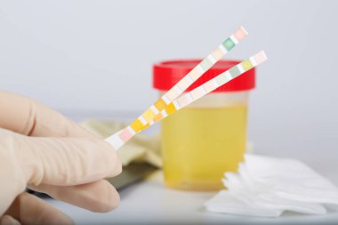 Koleksiyon Kupası ile idrar testi bir laborant bir tablo üzerinde. 