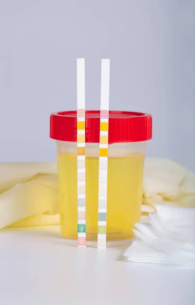 Collection cup with urine test on a table of a lab technician. — Stock Photo, Image