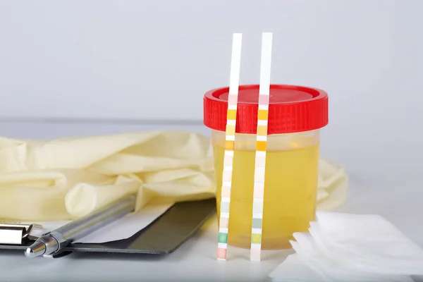 Collectie cup met urine testen op een tabel van een lab technicus. — Stockfoto