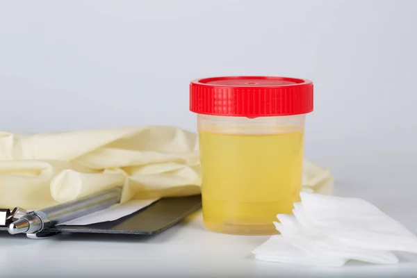 Collection cup with urine test on a table of a lab technician. — Stock Photo, Image