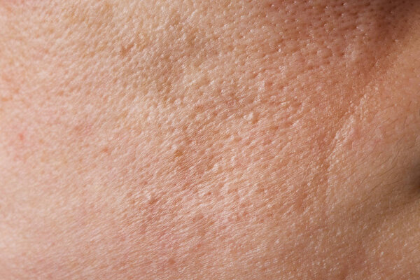 Skin of young lady between 30 and 35 years old. Closeup