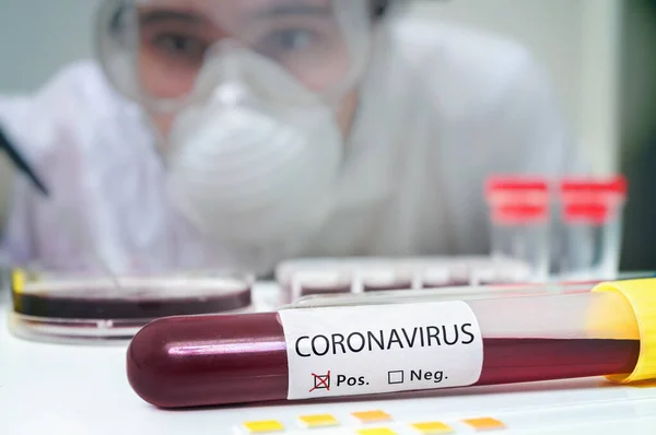 Pesquisador em laboratório está analisando amostra de sangue em tubo de ensaio — Fotografia de Stock