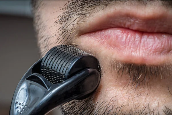 Facial Hair Care Concept Young Man Using Derma Roller Beard — Stock Photo, Image