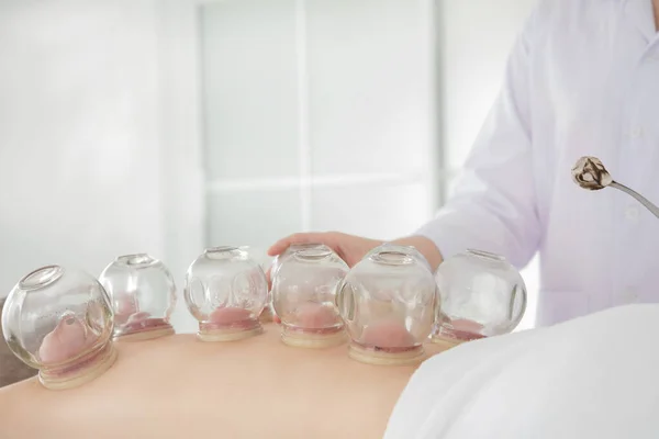 A Cupping-kezelést a beteg hátán végző terapeuta — Stock Fotó