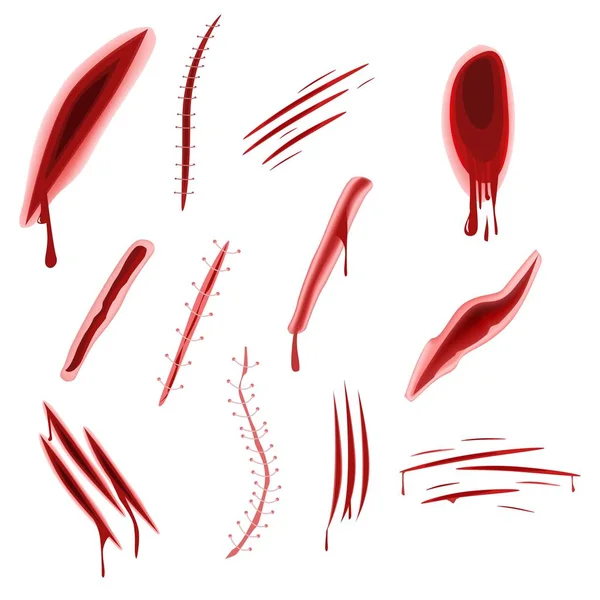 Grafiska realistiska sår set med blod stänk isolerad på vit bakgrund — Stock vektor