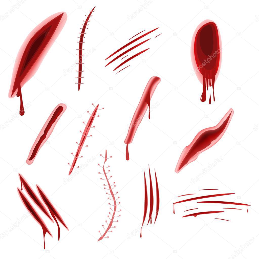 Graphic realistic wound set with blood splash isolated on white background