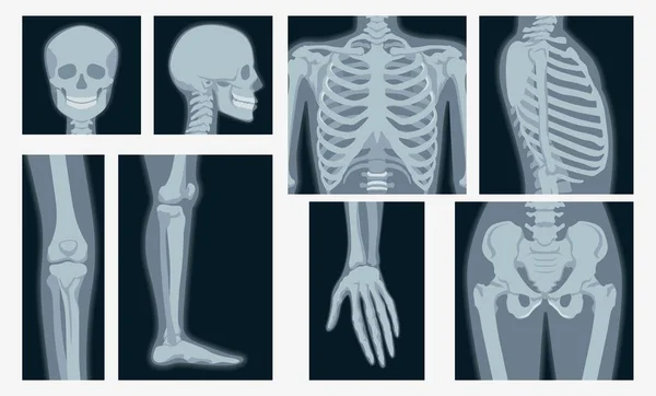 Diferentes rayos X de la parte del cuerpo humano conjunto vector ilustración plana — Vector de stock