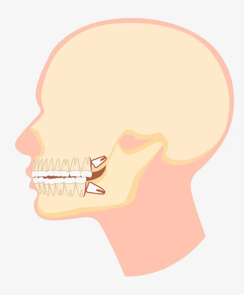 Modelo de dibujos animados de la mandíbula dental humana vista lateral vector ilustración plana — Archivo Imágenes Vectoriales
