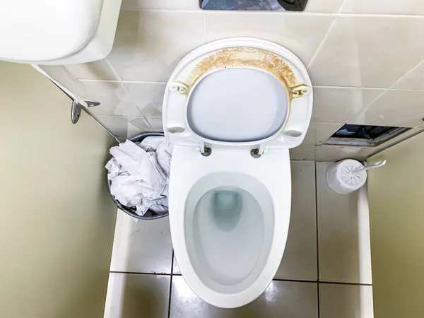 公衆トイレに汚れのある便器の汚れた不衛生な席閉じる — ストック写真