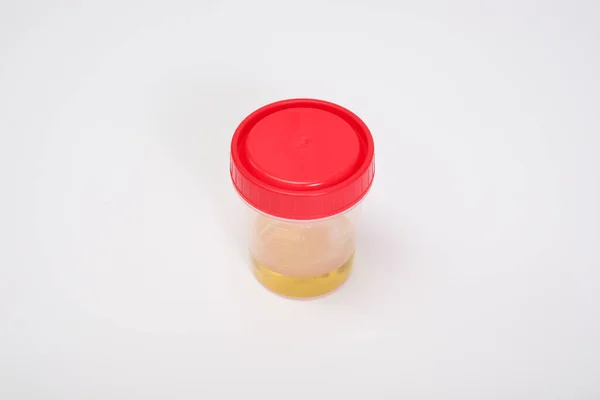 Amostra Urina Recipiente Plástico Exame Urina Fundo Branco Conceito Check — Fotografia de Stock