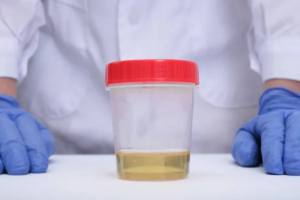 Échantillon Urine Dans Récipient Plastique Sur Une Table Devant Médecin — Photo