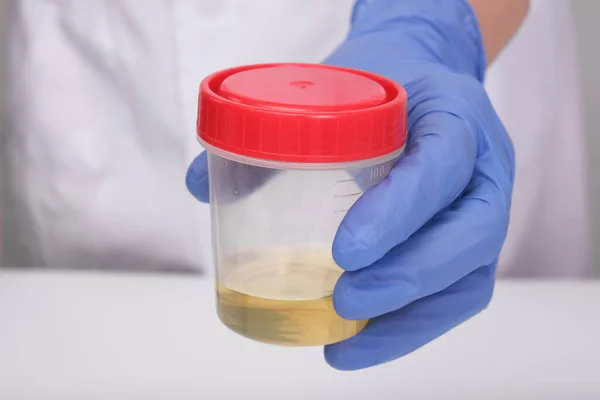 Bir doktor, mavi eldivenli laboratuvar teknisyeni plastik bir kapta idrar örneği, beyaz arka planda idrar analizi, tıbbi kontrol konsepti..