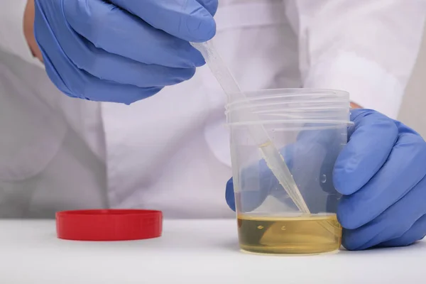 Médecin Technicien Laboratoire Gants Bleus Tenant Échantillon Urine Dans Récipient — Photo