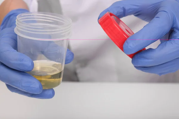 Médecin Technicien Laboratoire Ouvrant Échantillon Urine Dans Récipient Plastique Analyse — Photo