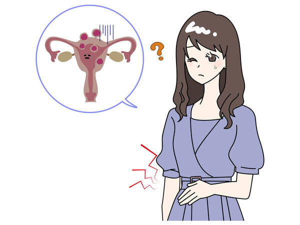 Illustration of a Woman Suffering from Uterine Myoma