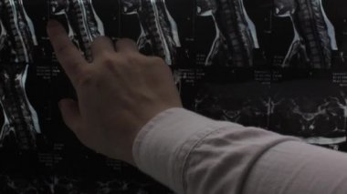 Kadınların boyun bölgesinin manyetik rezonans görüntüsü. Görüntü güneşten görünür..