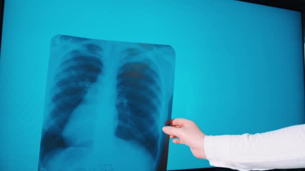 COVID-19. Pneumonie pulmonaire à l'image d'un patient. Docteur en médecine. Voir Analyse diagnostique. Centre de rayons X .