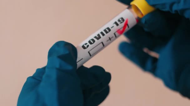 ウイルス検査用血液検査管チェック 肯定的な結果 — ストック動画