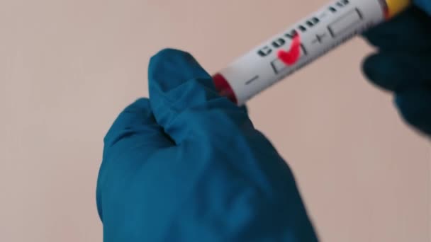 Negatives Blutbild Vitro Verbesserung Des Zustandes Des Patienten — Stockvideo