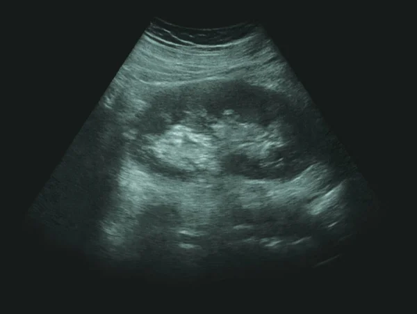 İnsan ultrasonu X-ray test ilacı