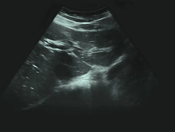 Human Ultrasound Ray Test Medicine — kuvapankkivalokuva