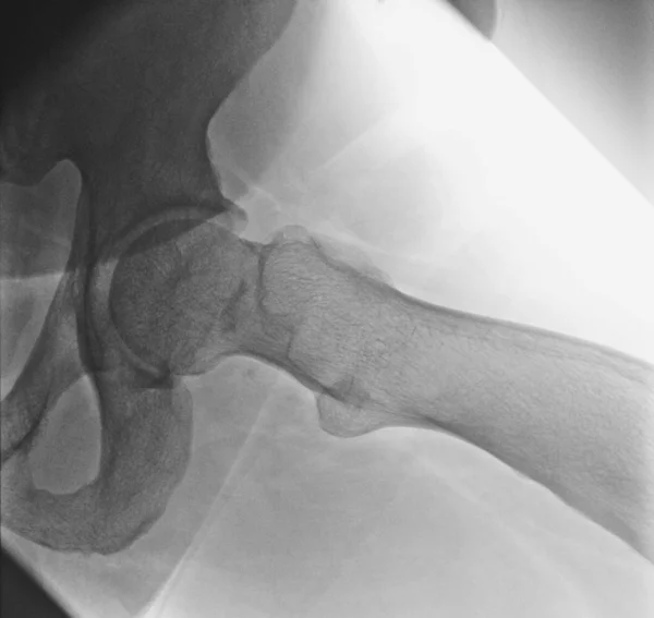 Anatómia Röntgen Betegség Diagnózis — Stock Fotó